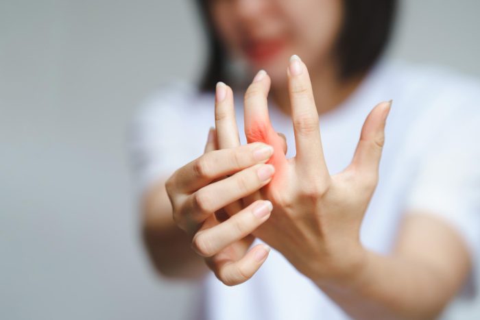 Dores nas Mãos Durante o Exercício: Como Evitar e Lidar com o Desconforto