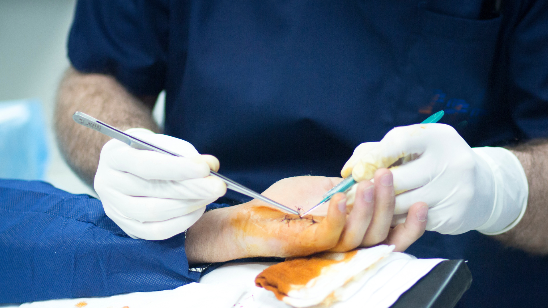 O Que Um Cirurgião de Mão Faz?